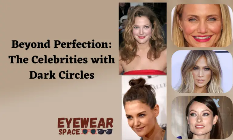 Beyond Perfection: The Celebrities with Dark Circles